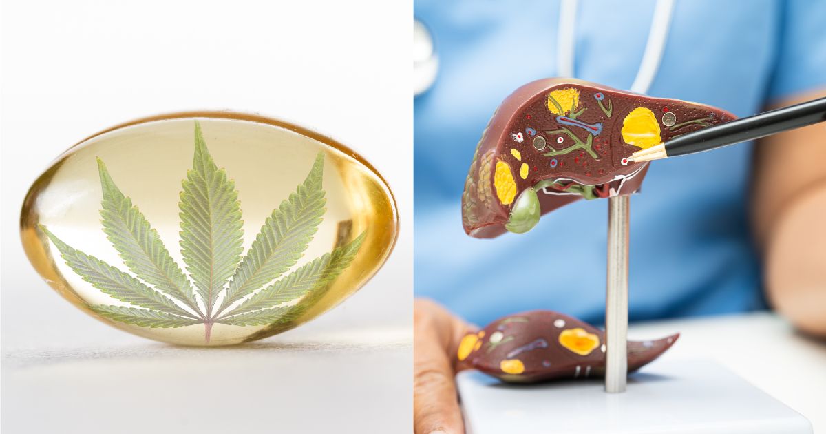 Split image showing a translucent golden-yellow capsule with a green cannabis leaf inside on the left, symbolizing CBD and CBG products. The right side features a medical model of a human liver, with highlighted structures in yellow, brown, and green. A person in blue medical attire points to the liver model with a pen, suggesting a focus on liver health. Keywords: CBD and CBG for liver disease
